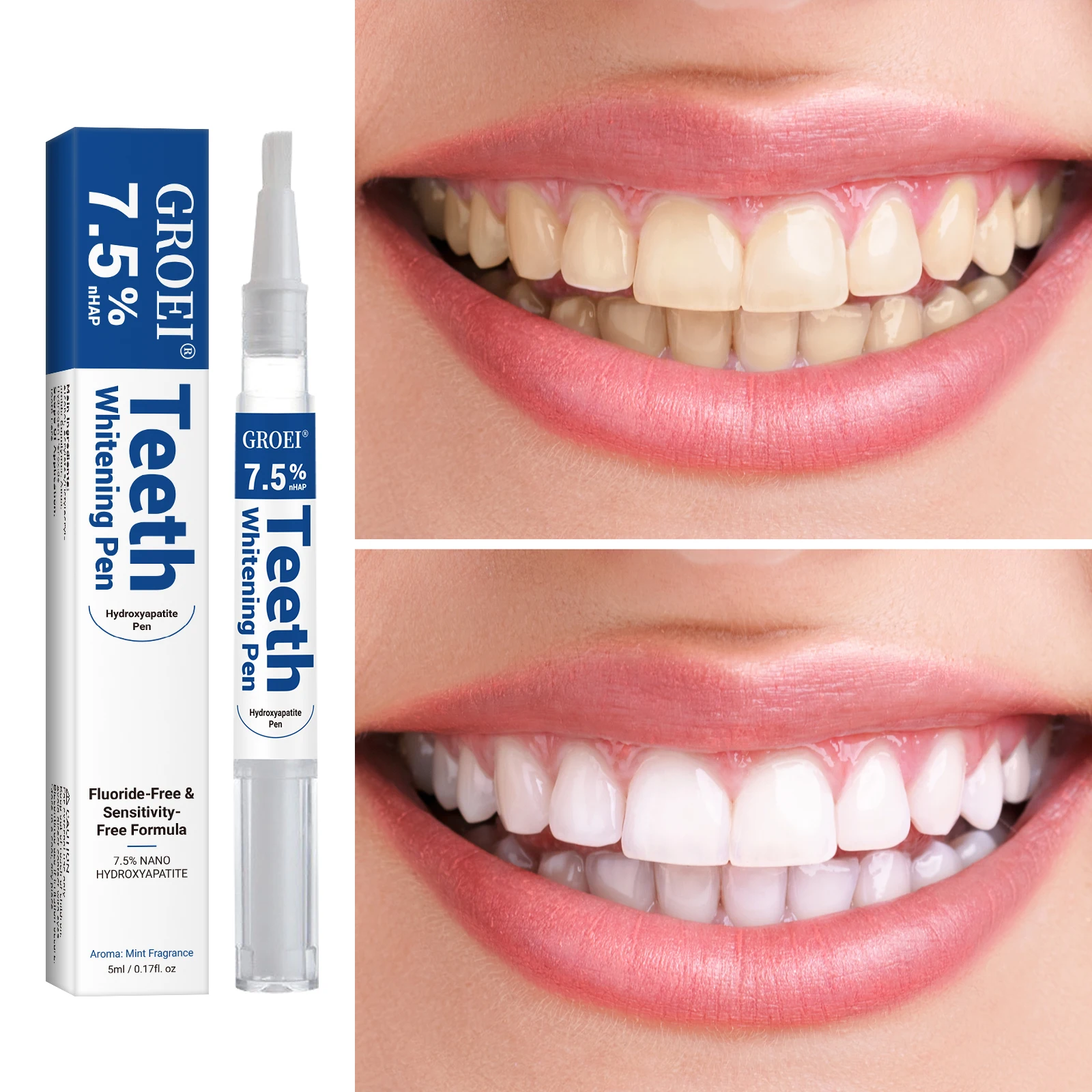Hydroxyapatite Tooth Whitening - Teeth Whitening Session 评论和价格