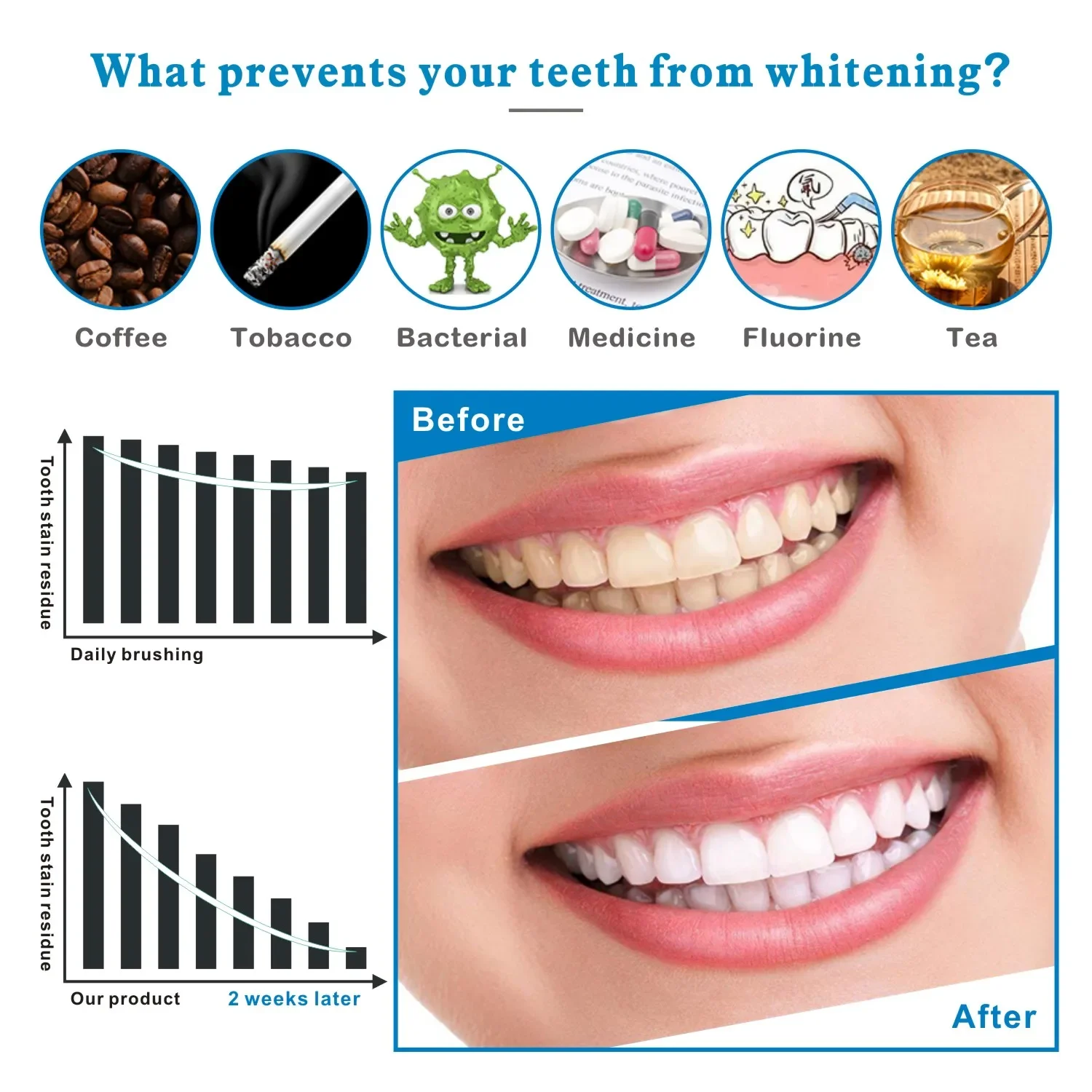 14/28pcs 3D Teeth Whitening St - Whitening Strip 3D 评论和价格